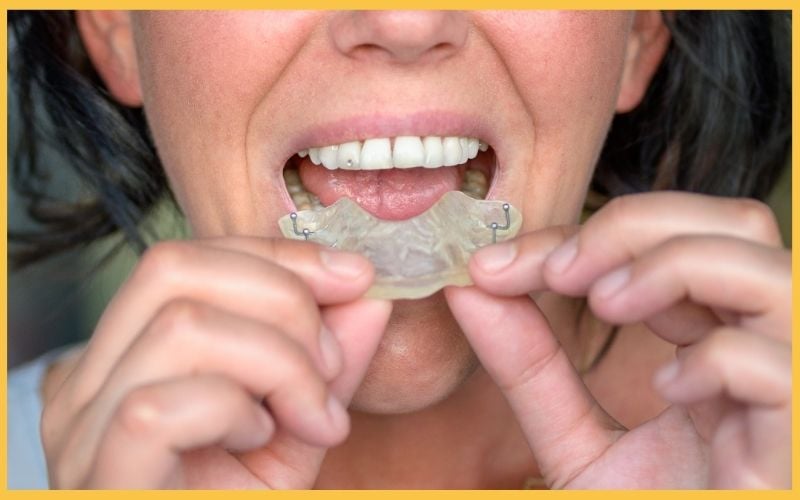 A close-up of a smiling woman holding a dental retainer to her mouth, showcasing her bright teeth and the retainer's clear design.